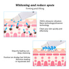 Ultrasonic Facial Cleanser with Pore Vacuum Device